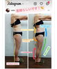 「筋膜＆軟部キャンペーン」
