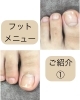 「フットメニューのご紹介！　巻き爪ケア」