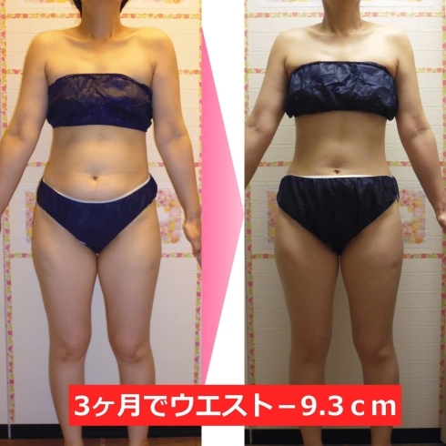 ダイエット1ヶ月間で7キロ痩せた 米子市上福原でダイエットを13年間行っている整体 美容サロン フェールラヴィ 骨盤矯正ダイエット キャビテーション デトックスリンパ 痩身整体 小顔矯正 Faire Ravie フェールラヴィ のニュース まいぷれ 米子