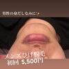「ひげ脱毛！！でストレスフリーに！！」