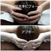 頭のむくみが取れてスッキリ＼(^o^)／「脳洗浄で頭痛スッキリ！初回30%OFF」