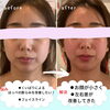 モニターさま「お口の整体　モニターさま」