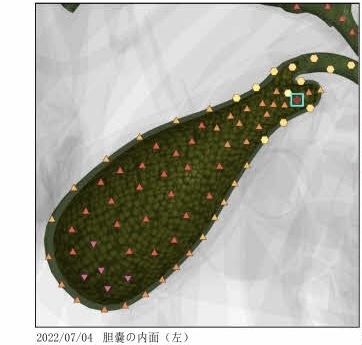 右胸が痛む人は「【右胸の痛みの原因は】メタトロン波動測定でお客様に起こった事 メタトロン鳥取　米子　鳥取氣功院」