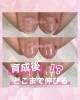 「【自爪育成】育成後どこまで伸びる？」