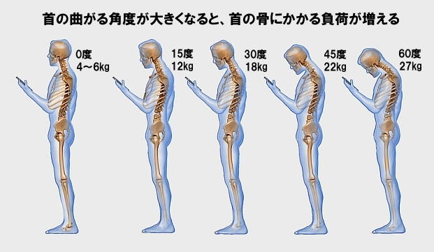 スマホや本を読む時の姿勢には十分注意しましょう！「1日に何時間スマホやパソコンを使っていますか？」