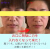 お口の整体「モニターさま」