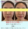 モニターさま「お口の整体モニターさま」
