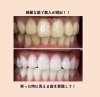 綺麗な歯で美人続出 Whitening Care ホワイトニングケア のニュース まいぷれ 新居浜市