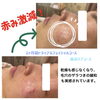 「お客様体験談『美白ケアコース使用感・効果は？』」