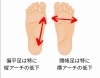 開帳足と扁平足「中高生のこむら返りの原因｜足の内在筋と開帳足の関係 」