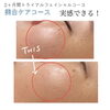 「お客様体験談『美白ケアコースいかがでしたか？』」