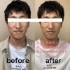 メンズフェイシャルエステ 宮崎市 宮崎市小顔 宮崎市メンズエステ Relax Beauty Palm リラックス ビューティー パーム のニュース まいぷれ 宮崎