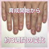 「3週間の変化【深爪/育成/福井ネイル】」