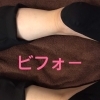 足のねっこりとり