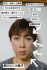 島根初！筋膜変形術！美容整形？って位「島根初！筋膜変形術！」
