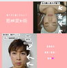 小顔、たるみ、若返り「島根初！たるみ、小顔、若返り！筋膜変形術！」