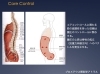 コアスタビリティ(ローカルシステム)「腰痛とコアスタビリティ」