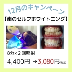 歯のセルフホワイトニング [２回照射] 2,800（税別）です(^^♪　
