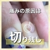 「足の爪の切り方【福井市/ネイルサロン/フットケア】」