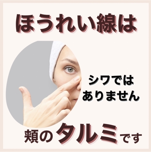 「【福井市エステ】ほうれい線をなくすには☝︎頬のたるみを改善する必要があります！」