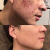 「Before&After」