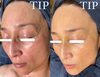 肌質改善集中プログラム「7月より新しい技術【 肌再生プログラム TIPハーブピーリング】が始まりました！」