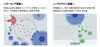 エクソソーム「エクソソーム再生医療と脳梗塞」
