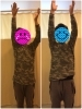 肩のbefore・after「腕が上がらない！という方の　before　after【豊明市前後駅からすぐの鍼灸院】」