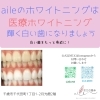メディカルホワイトニング「メディカルホワイトニング」