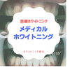 メディカルホワイトニング「メディカルホワイトニング」