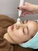 フリマトール「小鼻の黒ずみと頬の毛穴開きには毛穴洗浄を🧹【出雲のエステ Cure Spot ReFace】」