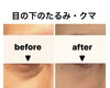 「目の下のたるみ・クマのない目元に【福井市エステ】」