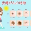 皮膚科でほくろ診断、形成外科で手術