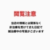 閲覧注意です「針治療受けてきました！」