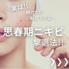 思春期ニキビ撃退法！！【千歳市/ニキビ/おでこニキビ/ニキビ跡/毛穴の開き/白ニキビ/赤ニキビ/大人ニキビ/皮脂/脂性/毛穴専用洗顔/ニキビ専用洗顔/まるみちゃん/紫外線/日焼け止め/肌質改善/V3ファンデーション/恵庭/北広島/苫小牧】