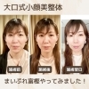 痛くない小顔矯正☆【千歳市／小顔／フェイシャル／エステ／たるみ／ほうれい線／脱マスク／しわ／シワ／老化／毛穴／小顔矯正／大口式／ヘッドスパ／おしゃれ／ニキビ／V3ファンデーション／むくみ／恵庭／北広島／苫小牧】