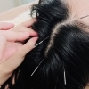 頭と肩の疲れに特化した山本おすすめメニュー　現代病だからこそ試してほしい！