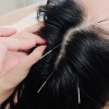頭と肩の疲れに特化した山本おすすめメニュー　現代病だからこそ試してほしい！