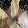 外反母趾知っていますか？