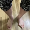 外反母趾知っていますか？