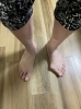 外反母趾「外反母趾知っていますか？」