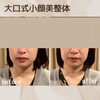 「人気の大口式小顔美整体♪ 【千歳市／小顔／フェイシャル／エステ／たるみ／ほうれい線／脱マスク／しわ／シワ／老化／毛穴／小顔矯正／大口式／ヘッドスパ／おしゃれ／ニキビ／V3ファンデーション／むくみ／恵庭／北広島／苫小牧】」
