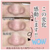 この変化感動します‼︎「毛穴ケア始めませんか？？」