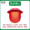 舌診：舌が赤い | 誠心堂薬局 南行徳本店のニュース | まいぷれ[市川市]