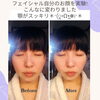 自分のお顔で実験 加工無し「え！言ってなかったよ最近 リンパトリートメント店 妃～プリンセス～」