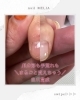 「怪我した指の育成【自爪育成/福井市】」