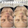 「シワ・シミ・くすみにお悩みの方にも  【 福井市 / エステ / ハーブピーリング / 陶肌トリートメント / ハードトリートメント / メンズフェイシャル  】」