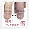「3週間の劇的変化【福井市ネイル/自爪育成】」