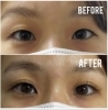 パッチリ目元に「まつ毛パーマ　before / after」