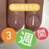 【Loveit nails】噛み癖克服〜･:*+.